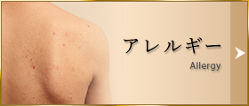 アレルギー